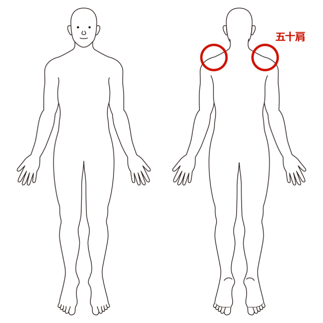 五十肩のイラスト