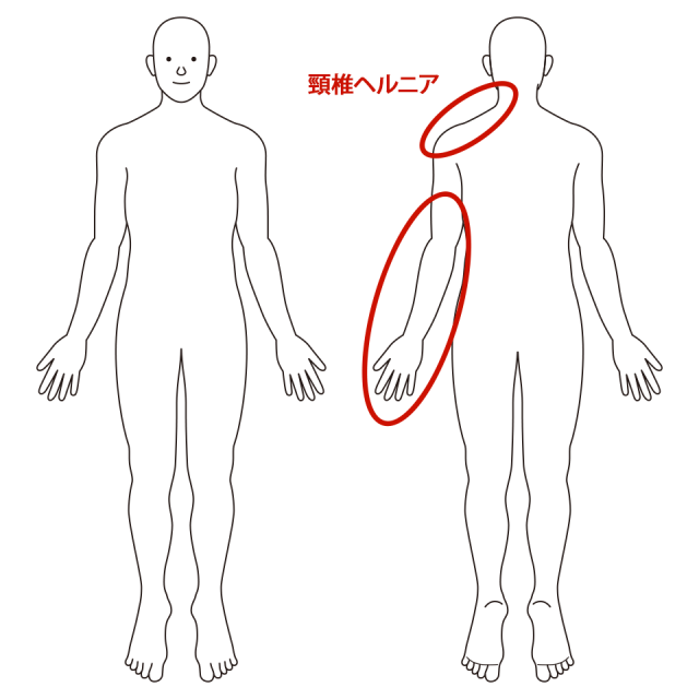 左の首から肩、腕、指先にかけて