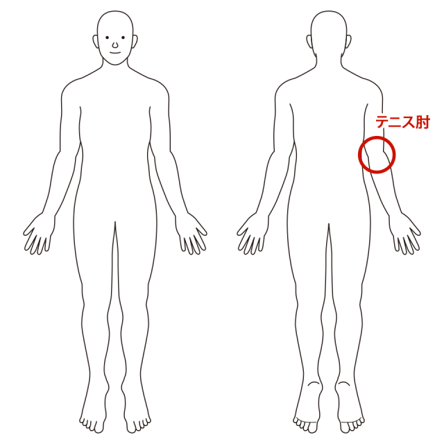 右肘の外側から前腕にかけて