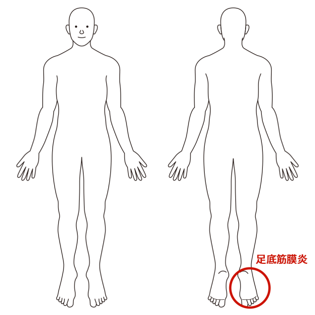 右足裏(踵から土踏まずにかけて)