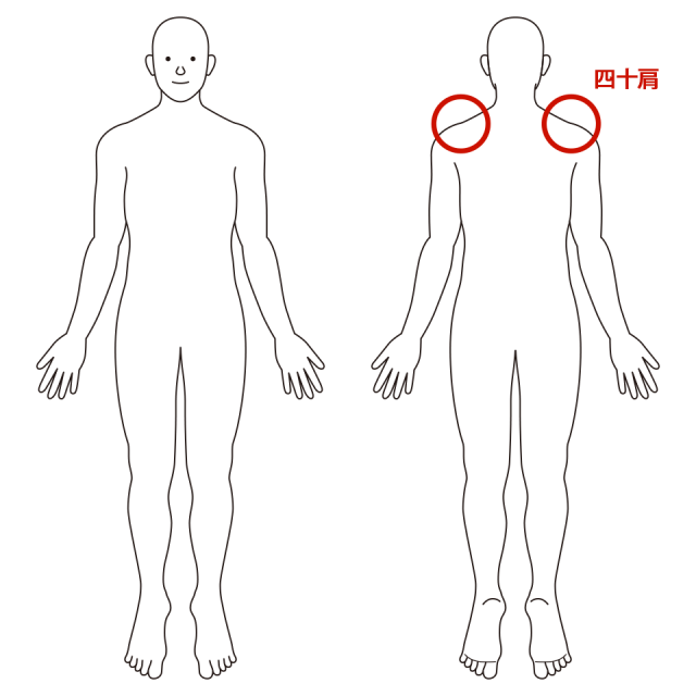 四十肩のイラスト