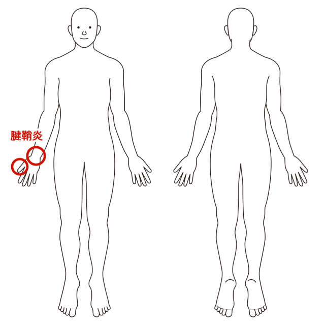 右手の親指と手首